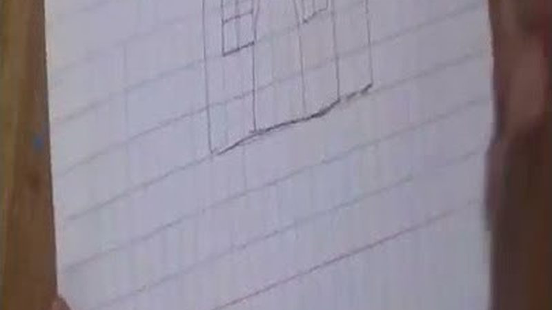 牙周治疗费用为何从几百到上万不等